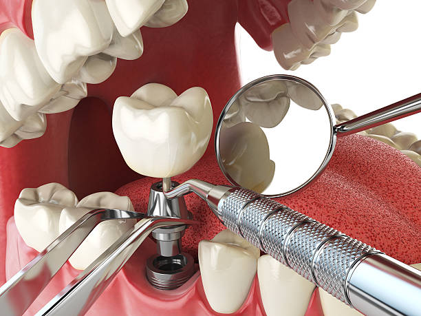 Best Walk-In Emergency Dentist in Sulphur Springs, AR
